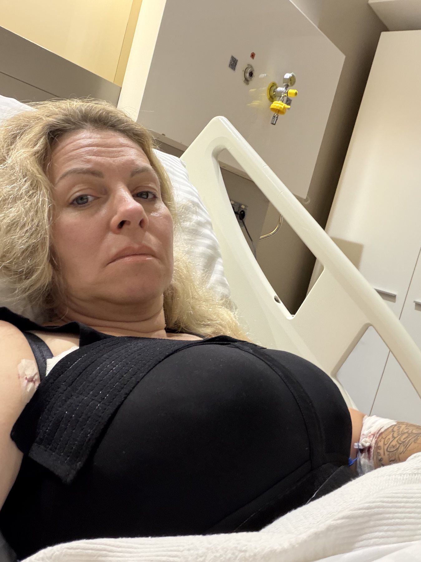 Tag eins nach der Operation, Kompressionsmieder im Klinikbett